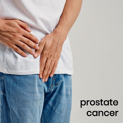 Prostate cancer